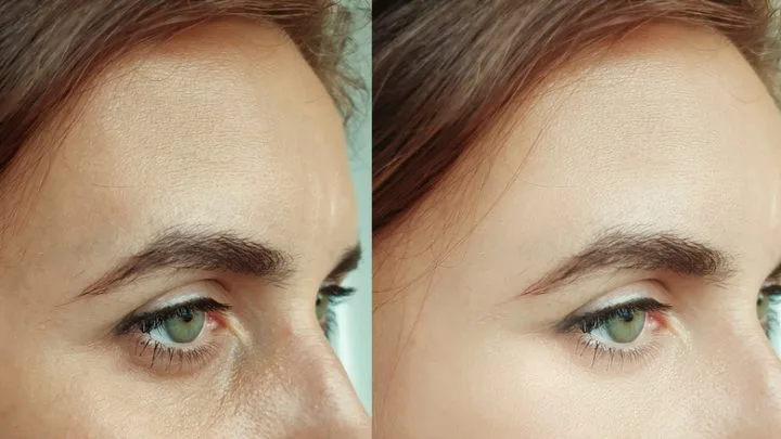 Why Concealer Looks Dry After Setting: The Real Reason