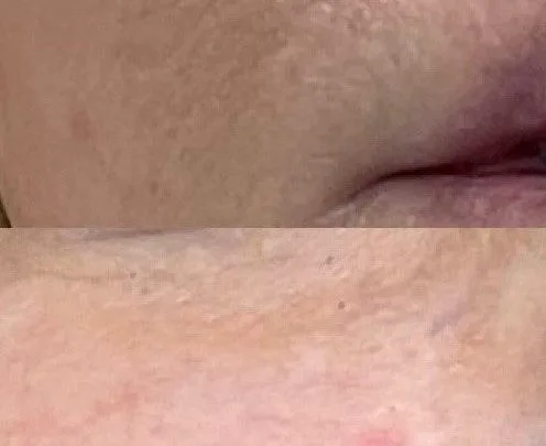 Why Does Makeup Separate Around Your Mouth?