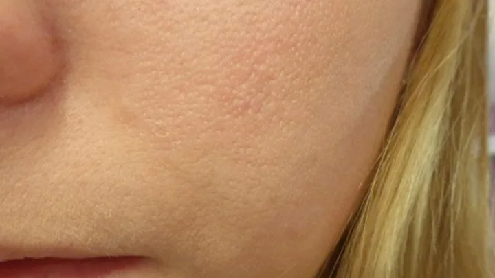 Why Primer Pills Under Foundation: Causes & Fixes